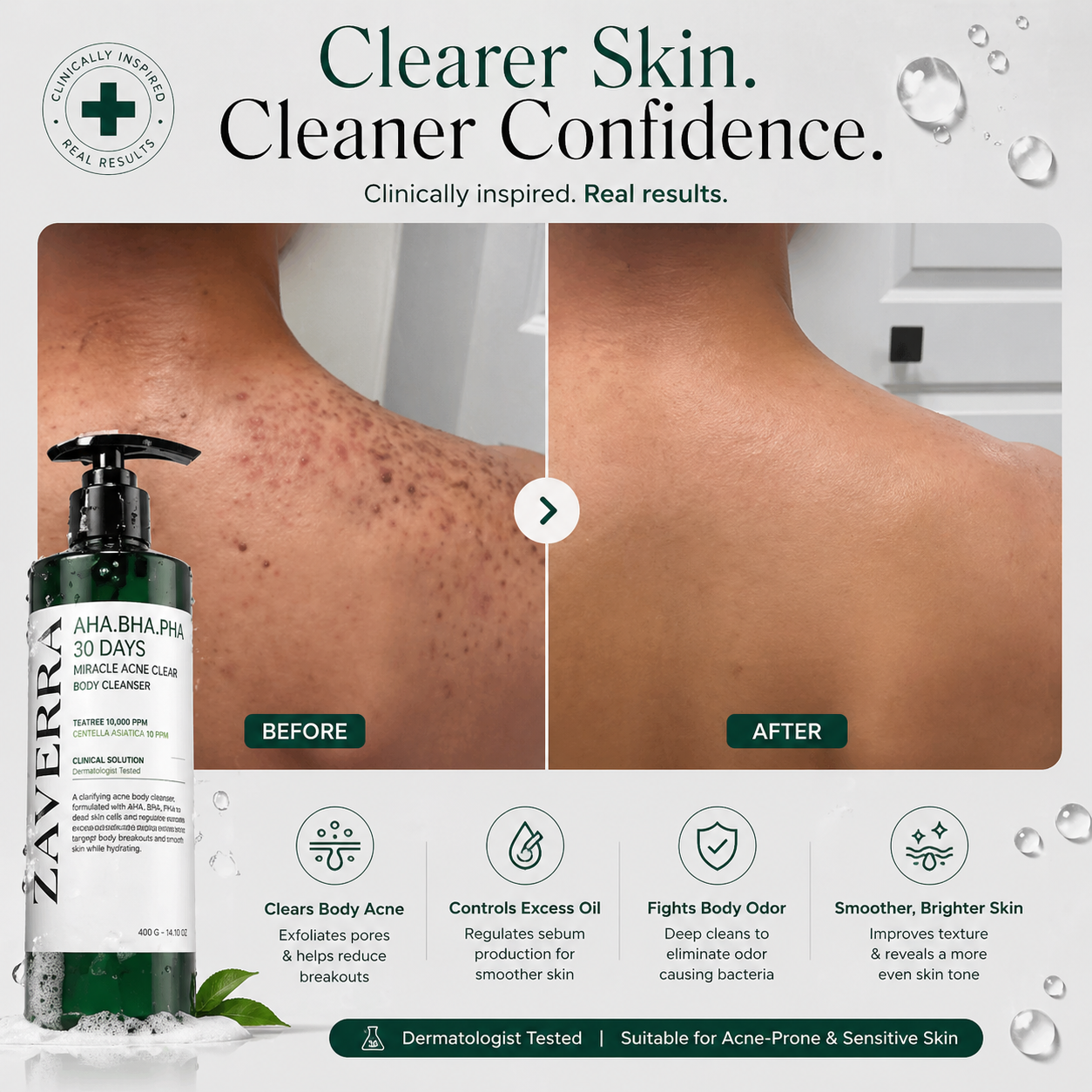 DermaClear Acne Body Wash
