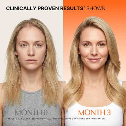 ELVIOR ROOTRISE™ Growth Routine Duo