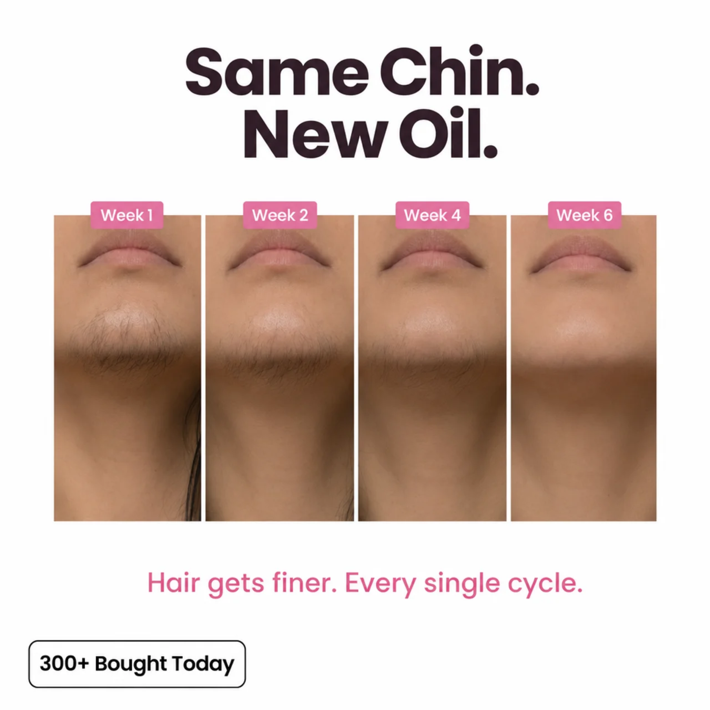 Elvior Regrowth Inhibitor Oil