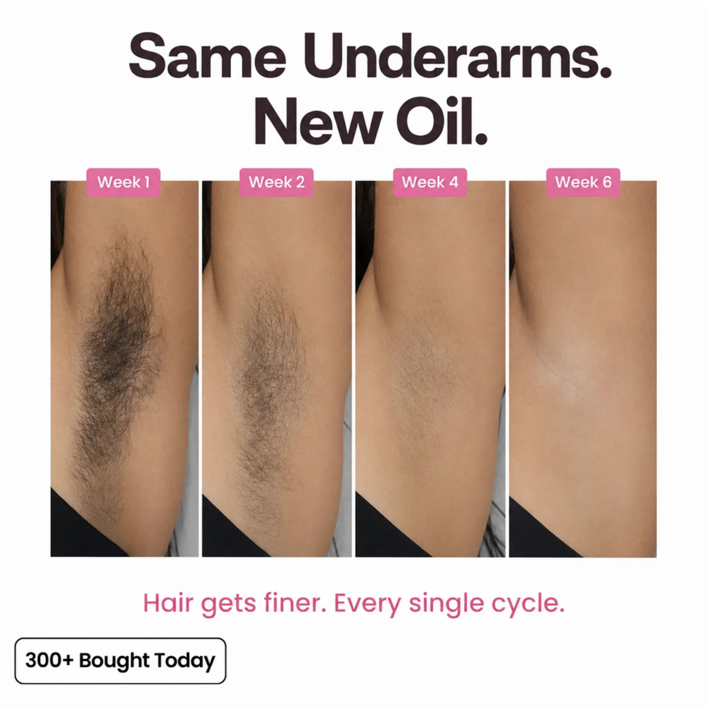 Elvior Regrowth Inhibitor Oil
