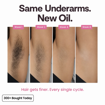 Elvior Regrowth Inhibitor Oil