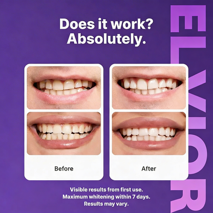 Purple Teeth Whitening Strips