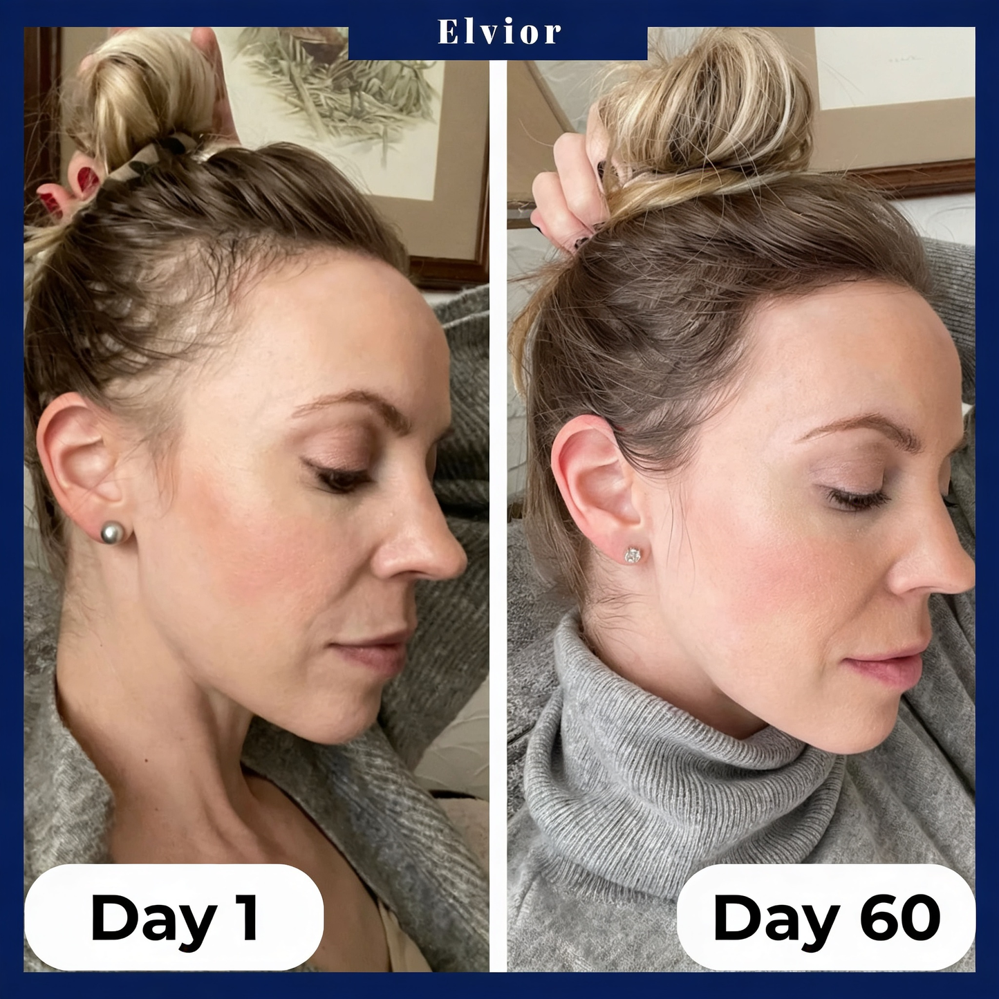 Elvior HairRevive Roll-On Serum