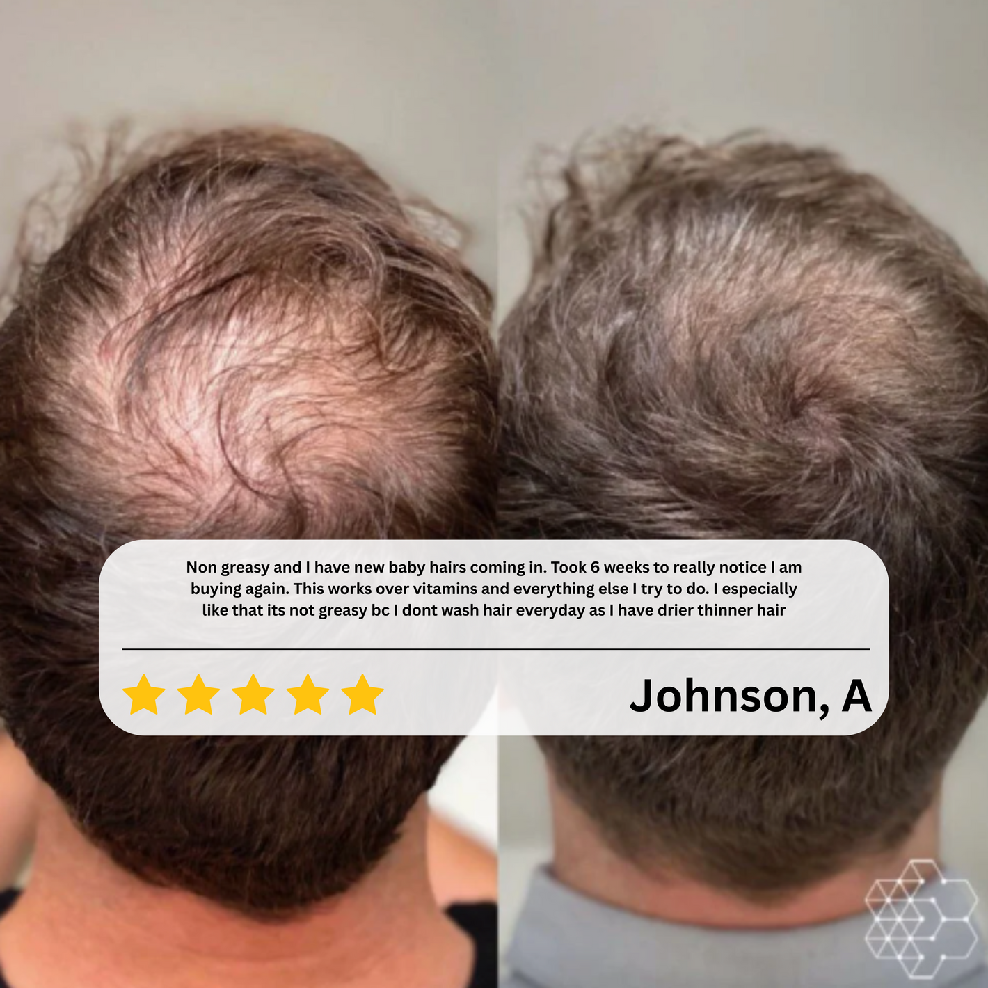 Elvior HairRevive Roll-On Serum