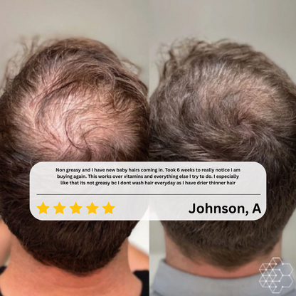 Elvior HairRevive Roll-On Serum