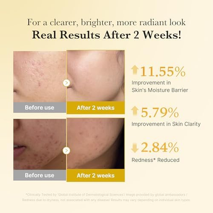 Elvior Kojic Acid Renew & Smooth Duo