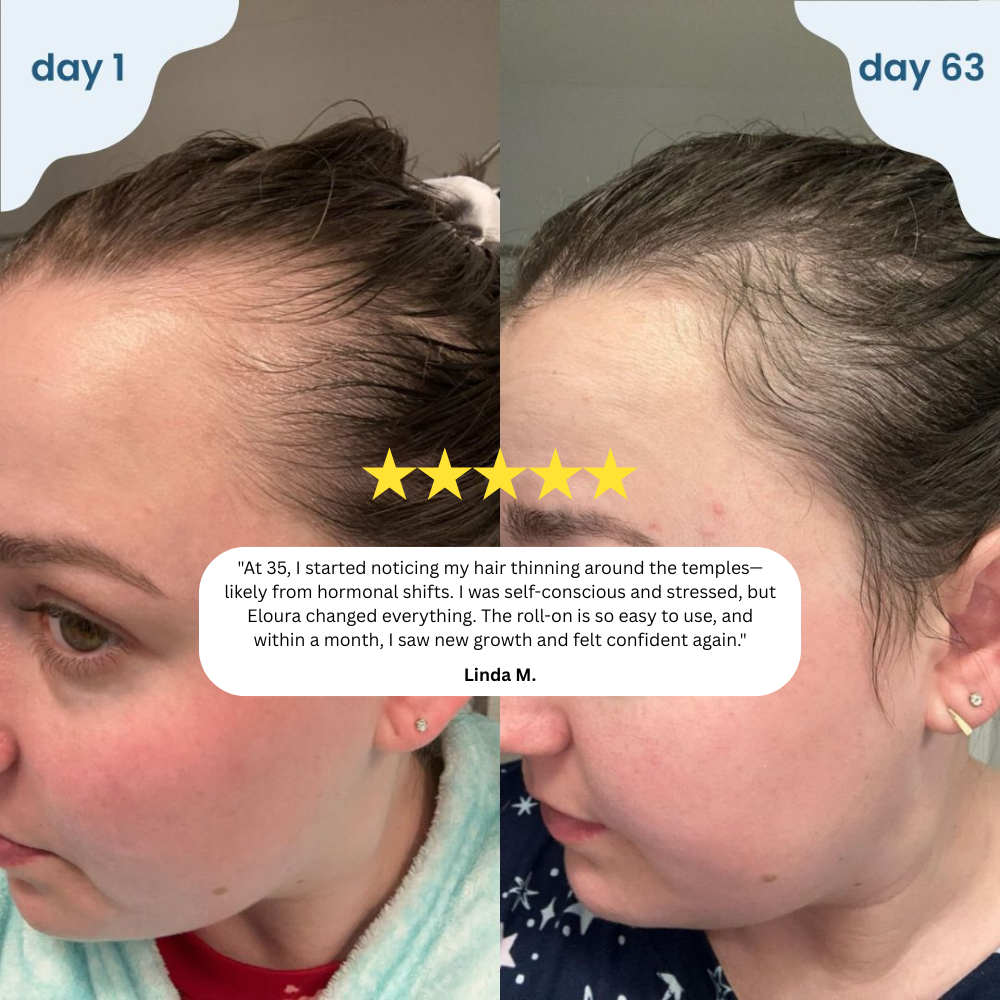 Elvior HairRevive Roll-On Serum